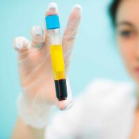 Joplin-Orthopedic-Platelet-Rich-Plasma-PRP-Injections-Ortho-Four-States-1-min.jpg